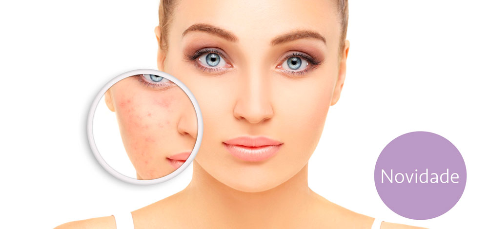 Tratamento para pele oleosa e com acne